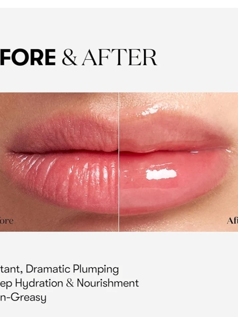 VTCOSMETICS Reedle Shot Lip Plumper - Picture 2 of 6